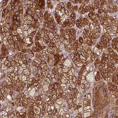 Immunohistochemistry-Paraffin: TBC1D4 Antibody [NBP2-38460]