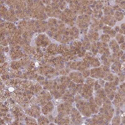 Immunohistochemistry-Paraffin: TBC1D4 Antibody [NBP2-38880]