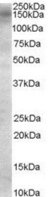 Western Blot: TBC1D4 Antibody [NB100-57094]