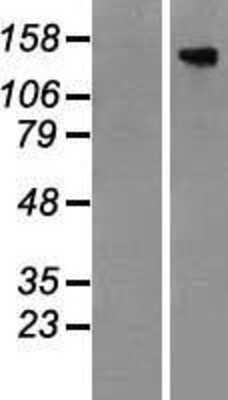 Western Blot: TBC1D4 Overexpression Lysate [NBP2-07277]