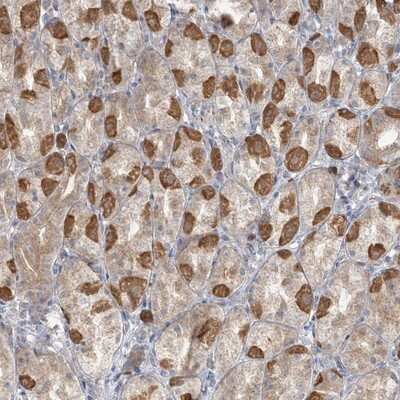 Immunohistochemistry-Paraffin: TBC1D5 Antibody [NBP1-93653]