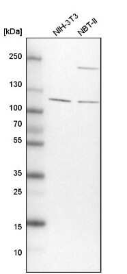 Western Blot: TBC1D5 Antibody [NBP1-93653]