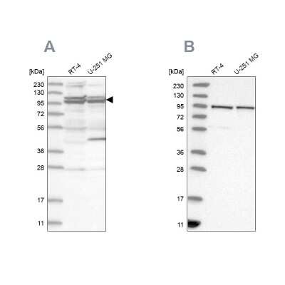 Western Blot: TBC1D5 Antibody [NBP1-93653]