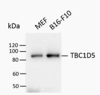 Western Blot: TBC1D5 Antibody [NBP2-38237]