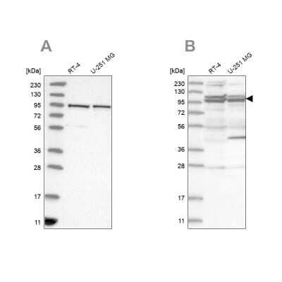 Western Blot: TBC1D5 Antibody [NBP2-38237]