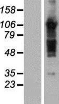 Western Blot: TBC1D5 Overexpression Lysate [NBP2-07281]