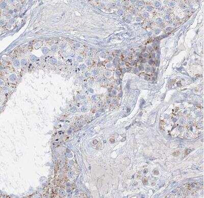 Immunohistochemistry-Paraffin: TBC1D7 Antibody [NBP1-84231]