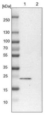 Western Blot: TBC1D7 Antibody [NBP1-84231]