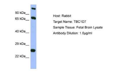 Western Blot: TBC1D7 Antibody [NBP2-85879]