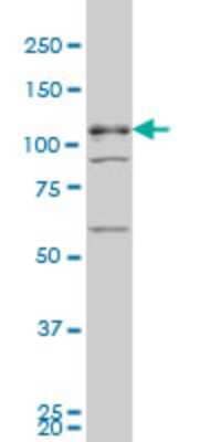 Western Blot: TBC1D8 Antibody (1A12) [H00011138-M02]