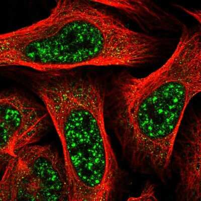 Immunocytochemistry/ Immunofluorescence: TBC1D8 Antibody [NBP2-58174]