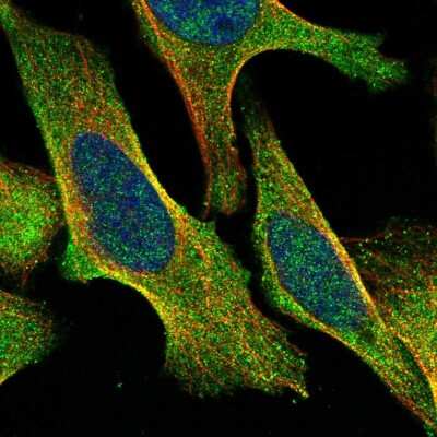 Immunocytochemistry/ Immunofluorescence: TBC1D8B Antibody [NBP1-82191]