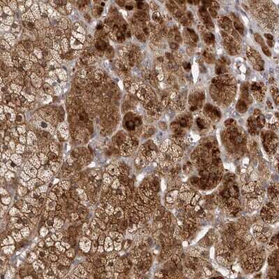 Immunohistochemistry: TBC1D8B Antibody [NBP1-82190]