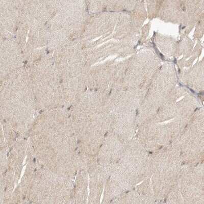 Immunohistochemistry-Paraffin: TBC1D8B Antibody [NBP1-82190]