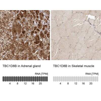 Immunohistochemistry-Paraffin: TBC1D8B Antibody [NBP1-82190]