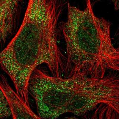 Immunocytochemistry/ Immunofluorescence: TBC1D9 Antibody [NBP2-13415]