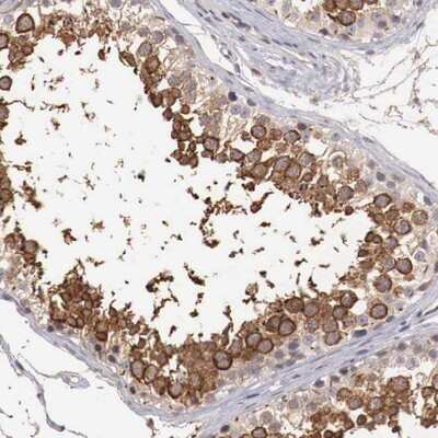 Immunohistochemistry-Paraffin: TBC1D9 Antibody [NBP2-13414]