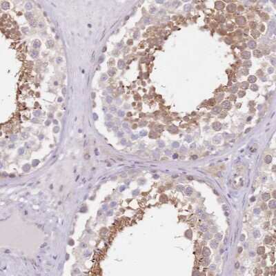 Immunohistochemistry-Paraffin: TBC1D9 Antibody [NBP2-13415]