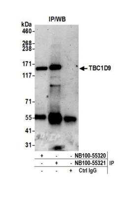 Immunoprecipitation: TBC1D9 Antibody [NB100-55320]