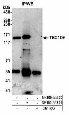 Immunoprecipitation: TBC1D9 Antibody [NB100-55321]