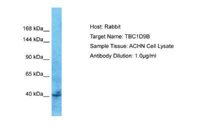 Western Blot: TBC1D9B Antibody [NBP2-83623]