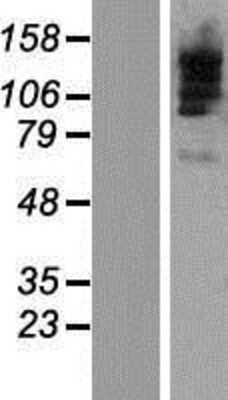 Western Blot: TBC1D9B Overexpression Lysate [NBP2-07226]