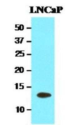 Western Blot: TBCA Antibody (1A5)BSA Free [NBP1-30168]