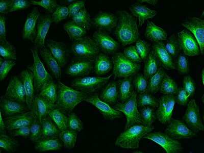 Immunocytochemistry/ Immunofluorescence: TBCA Antibody [NBP2-97322]