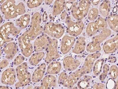 Immunohistochemistry-Paraffin: TBCA Antibody [NBP2-97322]