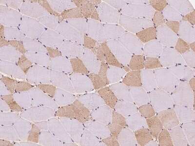 Immunohistochemistry-Paraffin: TBCA Antibody [NBP2-97322]