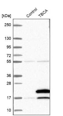 Western Blot: TBCA Antibody [NBP1-86288]