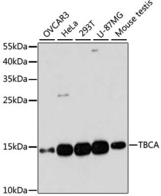 Western Blot: TBCA AntibodyAzide and BSA Free [NBP2-94247]