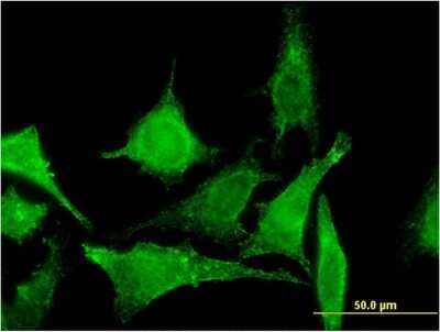 Immunocytochemistry/ Immunofluorescence: TBCC Antibody (3D3) [H00006903-M04]