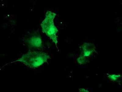 Immunocytochemistry/ Immunofluorescence: TBCC Antibody (OTI4C4) [NBP2-02037]