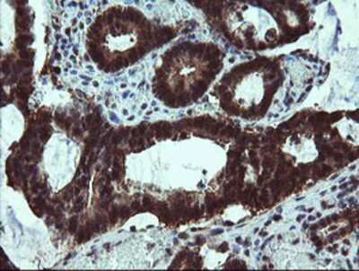 Immunohistochemistry-Paraffin: TBCC Antibody (OTI4C4) [NBP2-02037]
