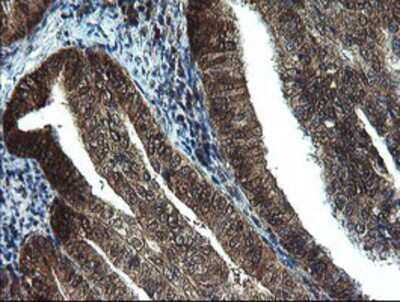 Immunohistochemistry-Paraffin: TBCC Antibody (OTI4C4) [NBP2-02037]