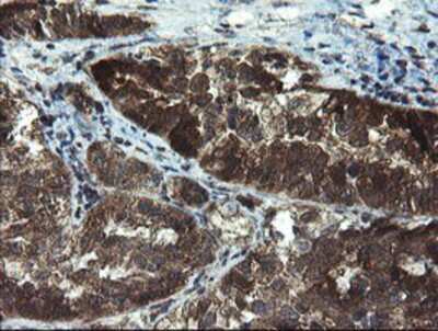 Immunohistochemistry-Paraffin: TBCC Antibody (OTI4C4) [NBP2-02037]