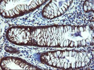 Immunohistochemistry-Paraffin: TBCC Antibody (OTI4C4) [NBP2-02037]