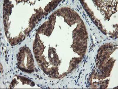 Immunohistochemistry-Paraffin: TBCC Antibody (OTI4C4) [NBP2-02037]
