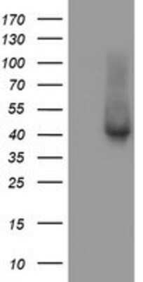 Western Blot: TBCC Antibody (OTI4C4) [NBP2-02037]