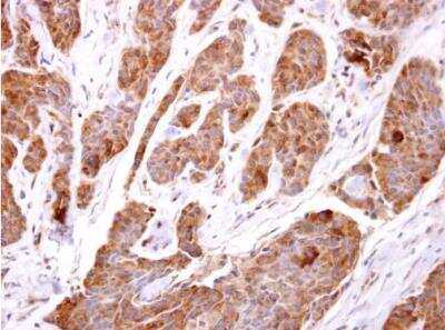 Immunohistochemistry-Paraffin: TBCC Antibody [NBP1-32425]
