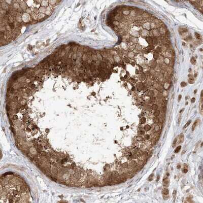 Immunohistochemistry-Paraffin: TBCC Antibody [NBP1-85679]