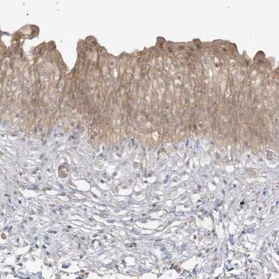 Immunohistochemistry-Paraffin: TBCC Antibody [NBP2-38233]