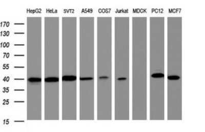 Western Blot: TBCC Antibody (OTI1B2)Azide and BSA Free [NBP2-74465]