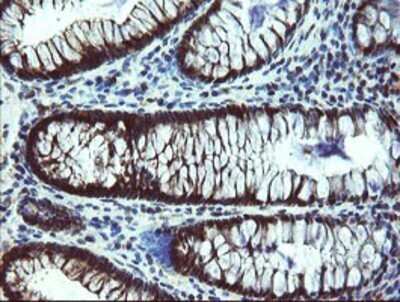 Immunohistochemistry: TBCC Antibody (OTI4C4) - Azide and BSA Free [NBP2-74467]