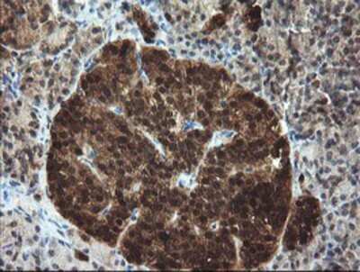 Immunohistochemistry: TBCC Antibody (OTI4C4) - Azide and BSA Free [NBP2-74467]