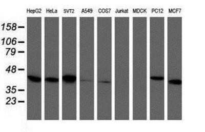 Western Blot: TBCC Antibody (OTI4C4)Azide and BSA Free [NBP2-74467]