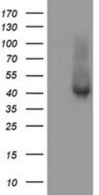 Western Blot: TBCC Antibody (OTI4C4)Azide and BSA Free [NBP2-74467]