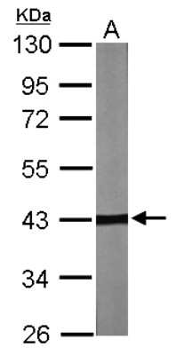 Western Blot: TBCC Antibody [NBP1-32425]