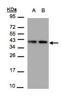 Western Blot: TBCC Antibody [NBP1-32425]